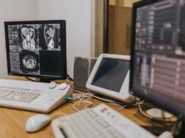 Hospital workstation with MRI scans on a monitor beside other medical screens.