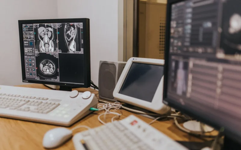 Hospital workstation with MRI scans on a monitor beside other medical screens.